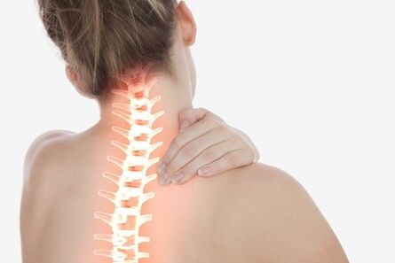 Osteocondrosis cervical